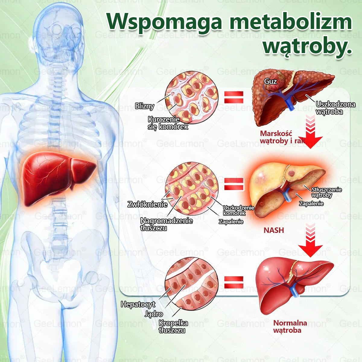 👩‍⚕️🎁 𝐆𝐞𝑒𝐿𝑒𝐦𝐨𝐧® 𝐆𝐥𝐮𝐦ase𝐭𝐢𝐝𝐞 𝟖 𝐰 𝟏 Smukły i Zdrowy Nano Plaster z Mikronakłuciami 🇵🇱(Tylko raz dziennie, widoczne zmiany już w 7 dni)✅ Na otyłość, 🅛🅞🅞🅢🅔 🅢🅚🅘🅝 wiotką skórę, cukrzycę, bezdech senny, problemy ze stawami i wiele więcej