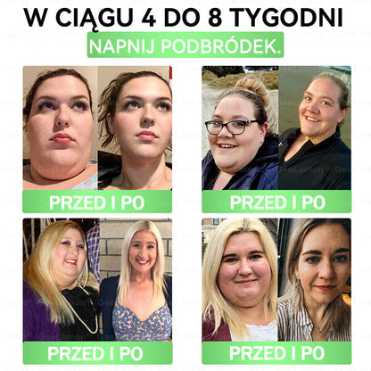 👩‍⚕️🎁 𝐆𝐞𝑒𝐿𝑒𝐦𝐨𝐧® 𝐆𝐥𝐮𝐦ase𝐭𝐢𝐝𝐞 𝟖 𝐰 𝟏 Smukły i Zdrowy Nano Plaster z Mikronakłuciami 🇵🇱(Tylko raz dziennie, widoczne zmiany już w 7 dni)✅ Na otyłość, 🅛🅞🅞🅢🅔 🅢🅚🅘🅝 wiotką skórę, cukrzycę, bezdech senny, problemy ze stawami i wiele więcej