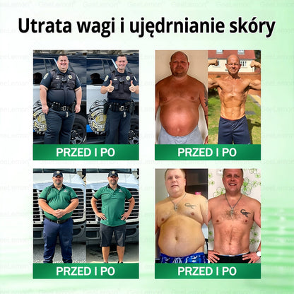 👩‍⚕️🎁 𝐆𝐞𝑒𝐿𝑒𝐦𝐨𝐧® 𝐆𝐥𝐮𝐦ase𝐭𝐢𝐝𝐞 𝟖 𝐰 𝟏 Smukły i Zdrowy Nano Plaster z Mikronakłuciami 🇵🇱(Tylko raz dziennie, widoczne zmiany już w 7 dni)✅ Na otyłość, 🅛🅞🅞🅢🅔 🅢🅚🅘🅝 wiotką skórę, cukrzycę, bezdech senny, problemy ze stawami i wiele więcej