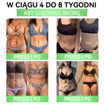 👩‍⚕️🎁 𝐆𝐞𝑒𝐿𝑒𝐦𝐨𝐧® 𝐆𝐥𝐮𝐦ase𝐭𝐢𝐝𝐞 𝟖 𝐰 𝟏 Smukły i Zdrowy Nano Plaster z Mikronakłuciami 🇵🇱(Tylko raz dziennie, widoczne zmiany już w 7 dni)✅ Na otyłość, 🅛🅞🅞🅢🅔 🅢🅚🅘🅝 wiotką skórę, cukrzycę, bezdech senny, problemy ze stawami i wiele więcej