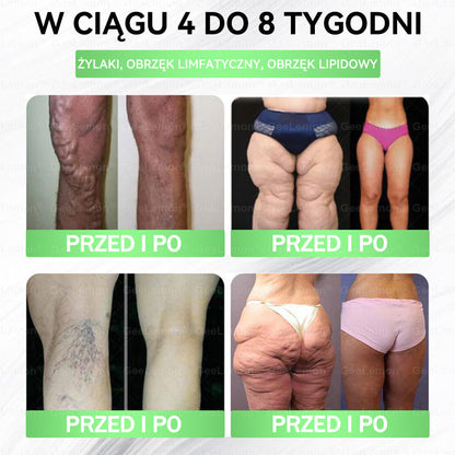 👩‍⚕️🎁 𝐆𝐞𝑒𝐿𝑒𝐦𝐨𝐧® 𝐆𝐥𝐮𝐦ase𝐭𝐢𝐝𝐞 𝟖 𝐰 𝟏 Smukły i Zdrowy Nano Plaster z Mikronakłuciami 🇵🇱(Tylko raz dziennie, widoczne zmiany już w 7 dni)✅ Na otyłość, 🅛🅞🅞🅢🅔 🅢🅚🅘🅝 wiotką skórę, cukrzycę, bezdech senny, problemy ze stawami i wiele więcej