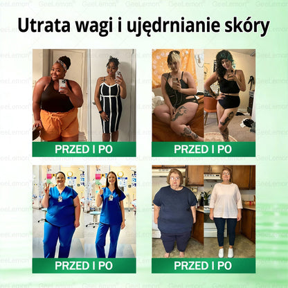 👩‍⚕️🎁 𝐆𝐞𝑒𝐿𝑒𝐦𝐨𝐧® 𝐆𝐥𝐮𝐦ase𝐭𝐢𝐝𝐞 𝟖 𝐰 𝟏 Smukły i Zdrowy Nano Plaster z Mikronakłuciami 🇵🇱(Tylko raz dziennie, widoczne zmiany już w 7 dni)✅ Na otyłość, 🅛🅞🅞🅢🅔 🅢🅚🅘🅝 wiotką skórę, cukrzycę, bezdech senny, problemy ze stawami i wiele więcej